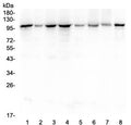 Western blot testing of human 1) HeLa, 2) placenta, 3) COLO-320, 4) SGC-7901, 5) HepG2, 6) K562, 7) Jurkat and 8) SK-OV-3 lysate with HSP105 antibody at 0.5ug/ml. Expected molecular weight: 105-110 kDa.