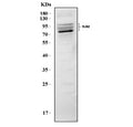 Western blot testing of mouse RAW264.7 cell lysate with Toll-like receptor 2 antibody. Predicted molecular weight: 85-90 kDa.