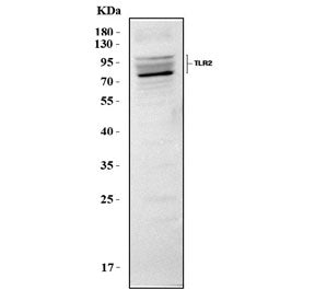 Western blot testing of mouse RAW264.7 cell lysate with Toll-like receptor 2 antibody. Predicted molecular weight: 85-90 kDa.