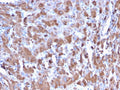IHC staining of FFPE human liver with C1QA antibody. HIER: boil tissue sections in pH 9 10mM Tris with 1mM EDTA for 10-20 min and allow to cool before testing.
