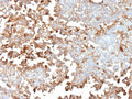 IHC staining of FFPE human adrenal gland tissue with Periostin antibody (clone POSTN/4096). HIER: boil tissue sections in pH 9 10mM Tris with 1mM EDTA for 20 min and allow to cool before testing.