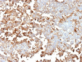 IHC staining of FFPE human adrenal gland tissue with Periostin antibody (clone POSTN/4096). HIER: boil tissue sections in pH 9 10mM Tris with 1mM EDTA for 20 min and allow to cool before testing.