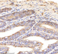 IHC staining of zebrafish Psmd8 protein using Zebrafish Psmd8 antibody, HRP-labeled secondary and DAB substrate. Psmd8 was detected in a paraffin-embedded section of zebrafish colon tissue. HIER: boil tissue sections in pH8 EDTA for 20 min and allow to cool before testing.