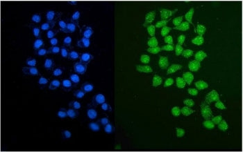 Immunofluorescent staining of FFPE human HepG2 cells with PARP2 antibody (green) and DAPI nuclear stain (blue). HIER: steam section in pH6 citrate buffer for 20 min.