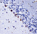 IHC testing of FFPE mouse cerebellum tissue with CKI-gamma 3 antibody. HIER: steam section in pH6 citrate buffer for 20 min and allow to cool prior to staining.