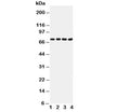 Western blot testing of Tau antibody and Lane 1: rat brain (40ug); 2: rat brain (50ug); 3: mouse brain (40ug); 4: mouse brain (50ug). Expected molecular weight: 50-80 kDa.