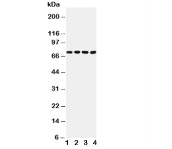 Western blot testing of Tau antibody and Lane 1: rat brain (40ug); 2: rat brain (50ug); 3: mouse brain (40ug); 4: mouse brain (50ug). Expected molecular weight: 50-80 kDa.