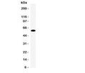Western blot testing of EAAT3 antibody and human placenta tissue lysate. Expected molecular weight: 57-70 kDa.