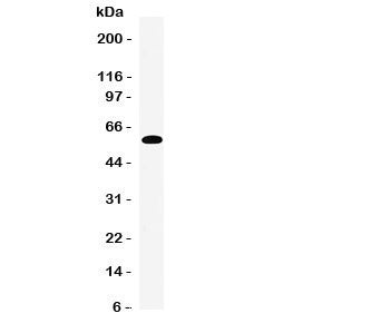 Western blot testing of EAAT3 antibody and human placenta tissue lysate. Expected molecular weight: 57-70 kDa.