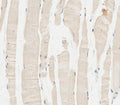 IHC testing of FFPE human skeletal muscle tissue with Glucosylceramidase beta antibody. HIER: steam section in pH6 citrate buffer for 20 min and allow to cool prior to staining.