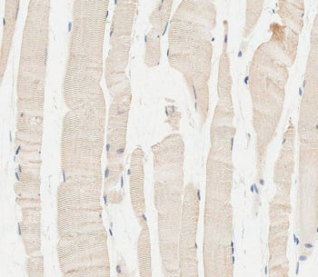 IHC testing of FFPE human skeletal muscle tissue with Glucosylceramidase beta antibody. HIER: steam section in pH6 citrate buffer for 20 min and allow to cool prior to staining.