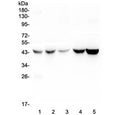 Western blot testing of human 1) placenta, 2) HEp-2, 3) HeLa, 4) A549 and 5) PANC-1 lysate with Alpha 1 microglobulin antibody at 0.5ug/ml. Predicted molecular weight: 26-28 kDa (Alpha 1 microglobulin), ~39 kDa (uncleaved AMBP). These proteins may be observed at higher molecular weights due to glycosylation.