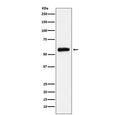 Western blot testing of human HepG2 cell lysate with ALDH2 antibody. Predicted molecular weight ~56 kDa.