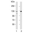 Western blot testing of human 1) Raji and 2) HL60 cell lysate with TERT antibody. Predicted molecular weight: 120-126 kDa (two isoforms may be visualized).