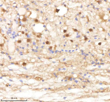 IHC staining of FFPE zebrafish spinal tissue with Psma1 antibody, HRP-labeled secondary and DAB substrate. HIER: boil tissue sections in pH8 EDTA for 20 min and allow to cool before testing.