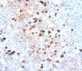 IHC testing of human tonsil stained with IgM heavy chain antibody.