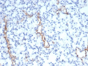 IHC staining of FFPE mouse lung with vWF antibody (clone VWF/4105). HIER: boil tissue sections in pH 9 10mM Tris with 1mM EDTA for 20 min and allow to cool before testing.