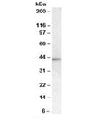 Western blot testing of human skin lysate with MC2R antibody at 1ug/ml. Predicted molecular weight: ~33/43kDa (unmodified/glycosylated).