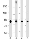 Western blot testing of human 1) HeLa, 2) Jurkat, 3) COS-7 and 4) mouse heart lysate with PFKP antibody at 1:4000. Predicted molecular weight: 86 kDa.