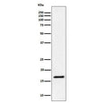 Western blot testing of human Jurkat cell lysate with UBE2L3 antibody. Predicted molecular weight ~18 kDa.