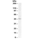 Western blot testing of Daudi lysate with LHX2 antibody at 1ug/ml. Predicted molecular weight ~44kDa.