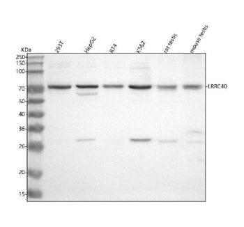 Western blot analysis of LRRC40 using anti-LRRC40 antibody. Lane 1: human 293T whole cell lysates, Lane 2: human HepG2 whole cell lysates, Lane 3: human RT4 whole cell lysates, Lane 4: human K562 whole cell lysates, Lane 5: rat testis tissue lysates, Lane 6: mouse testis tissue lysates. After electrophoresis, proteins were transferred to a nitrocellulose membrane at 150 mA for 50-90 min. Blocked the membrane with 5% non-fat milk/TBS for 1.5 hour at RT.
