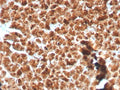 IHC testing of FFPE human pancreas with recombinant GP2 antibody. HIER: boil tissue sections in pH 9 10mM Tris with 1mM EDTA for 10-20 min and allow to cool before testing.