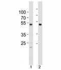 Western blot analysis of lysate from 1) HCT116 cell line and 2) human heart tissue using SOX7 antibody at 1:1000. Predicted molecular weight: 42/49 kDa (isoforms 1/2).