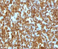 IHC testing of FFPE human tonsil and anti-CD45RA antibody (clone CDLA45RA-1). HIER: boil sections in pH6 10mM citrate buffer for 10-20 minutes, followed by cooling at RT for 20 minutes, prior to staining.