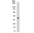 Western blot testing of A431 lysate with PDLIM4 antibody at 0.2ug/ml. Predicted molecular weight: ~35 kDa.