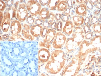 IHC staining of FFPE human kidney tissue with Interleukin 6 antibody (clone IL6/4643) at 2ug/ml. Inset: PBS used in place of primary Ab (secondary Ab negative control). HIER: boil tissue sections in pH 9 10mM Tris with 1mM EDTA for 20 min and allow to cool before testing.