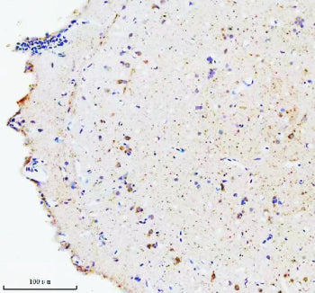 IHC staining of FFPE zebrafish brain tissue with Zebrafish Hsc70 antibody, HRP secondary and DAB substrate. HIER: boil tissue sections in pH8 EDTA for 20 min and allow to cool before testing.