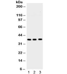 Western blot testing of 1) rat brain, 2) mouse brain and 3) human U87 lysate with Syntaxin 1a antibody. Expected molecular weight ~35 kDa.