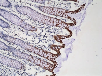 IHC testing of FFPE human colon tissue with recombinant CK20 antibody at 1:250.