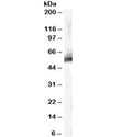 Western blot testing of human liver lysate with MDM2 antibody at 0.3ug/ml. Predicted molecular weight: ~55 kDa but can be observed at up to ~90 kDa.