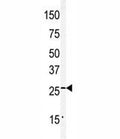 Western blot analysis of Claudin 2 antibody and mouse kidney tissue lysate.