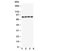 Western blot testing of SP4 antibody and Lane 1: rat spleen; and human samples 2: SGC; 3: HeLa; 4: Jurkat; 5: A549 cell lysate. Predicted/observed molecular weight ~82kDa.