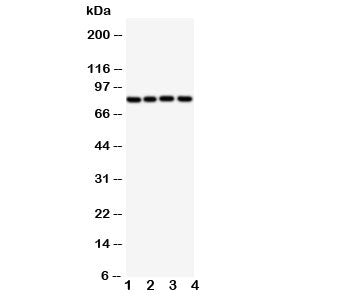 Western blot testing of SP4 antibody and Lane 1: rat spleen; and human samples 2: SGC; 3: HeLa; 4: Jurkat; 5: A549 cell lysate. Predicted/observed molecular weight ~82kDa.