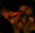 Immunofluorescent staining of PMM2 using anti-PMM2 antibody (green) and anti-Beta Tubulin antibody (red). PMM2 was detected in immunocytochemical section of HELA cell. Enzyme antigen retrieval was performed using IHC enzyme antigen retrieval reagent for 15 mins. The cells were blocked with 10% goat serum. And then incubated with 5 ug/ml rabbit anti-PMM2 antibody and mouse anti-Beta Tubulin antibody overnight at 4oC.