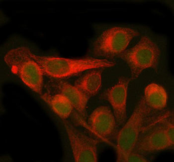 Immunofluorescent staining of PMM2 using anti-PMM2 antibody (green) and anti-Beta Tubulin antibody (red). PMM2 was detected in immunocytochemical section of HELA cell. Enzyme antigen retrieval was performed using IHC enzyme antigen retrieval reagent for 15 mins. The cells were blocked with 10% goat serum. And then incubated with 5 ug/ml rabbit anti-PMM2 antibody and mouse anti-Beta Tubulin antibody overnight at 4oC.