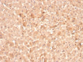 IHC staining of FFPE human liver with F7 antibody. HIER: boil tissue sections in pH 9 10mM Tris with 1mM EDTA for 20 min and allow to cool before testing.
