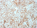 IHC staining of FFPE human tonsil tissue with CD73 antibody (clone NT5E/2503). HIER: boil tissue sections in pH9 10mM Tris with 1mM EDTA for 10-20 min and allow to cool before testing.