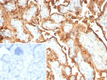 IHC staining of FFPE human placental tissue with recombinant S100P antibody (clone rS100P/9254). Inset: PBS used in place of primary Ab (secondary Ab negative control). HIER: boil tissue sections in pH 9 10mM Tris with 1mM EDTA for 20 min and allow to cool before testing.