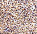 IHC staining of FFPE human liver tissue with Apolipoprotein H antibody, HRP-secondary and DAB substrate. HIER: boil tissue sections in pH8 EDTA for 20 min and allow to cool before testing.