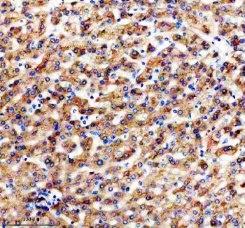 IHC staining of FFPE human liver tissue with Apolipoprotein H antibody, HRP-secondary and DAB substrate. HIER: boil tissue sections in pH8 EDTA for 20 min and allow to cool before testing.