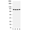 Western blot testing of CUL2 antibody and human samples 1: A431; 2: SMMC-7721; 3: HeLa; 4: COLO320 cell lysate. Predicted/observed molecular weight: ~87 kDa.