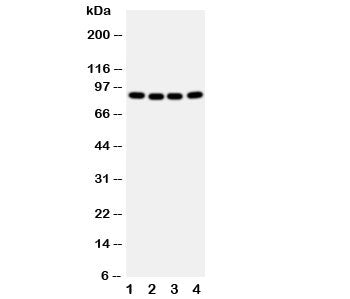 Western blot testing of CUL2 antibody and human samples 1: A431; 2: SMMC-7721; 3: HeLa; 4: COLO320 cell lysate. Predicted/observed molecular weight: ~87 kDa.