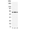 Western blot testing of EAAT3 antibody and Lane 1: rat liver; 2: rat heart; 3: mouse HEPA cell lysate; Expected molecular weight: 57-70 kDa.