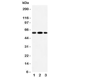 Western blot testing of EAAT3 antibody and Lane 1: rat liver; 2: rat heart; 3: mouse HEPA cell lysate; Expected molecular weight: 57-70 kDa.