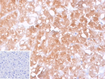 IHC staining of FFPE human hepatocellular carcinoma tissue with CYP2C9 antibody (clone CYP2C9/13121). Inset: PBS used in place of primary Ab (secondary Ab negative control). HIER: boil tissue sections in pH 9 10mM Tris with 1mM EDTA for 20 min and allow to cool before testing.